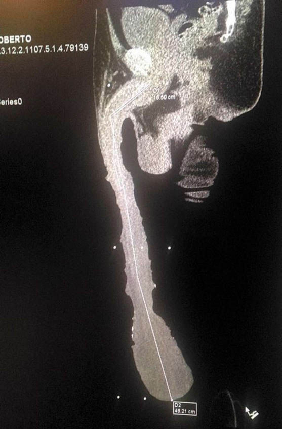 net dating talgkjertler på penis net dating talgkjertler på penis